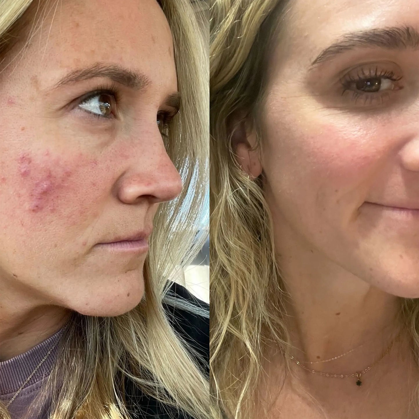 Advanced Recovery Serum